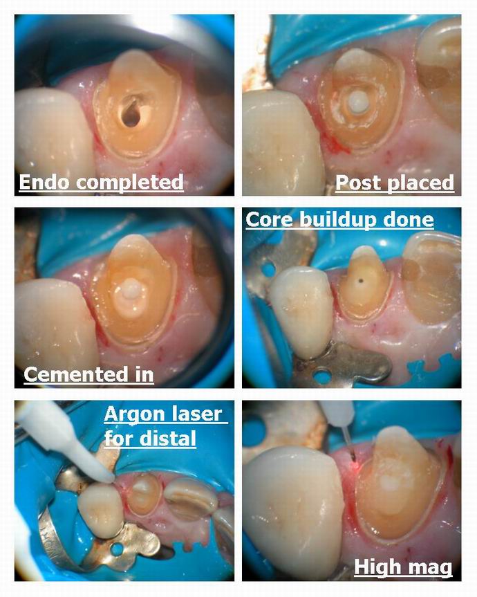 Hard tissue vs soft tissue pg 1.jpg